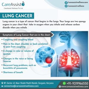 Lung cancer treatment in india