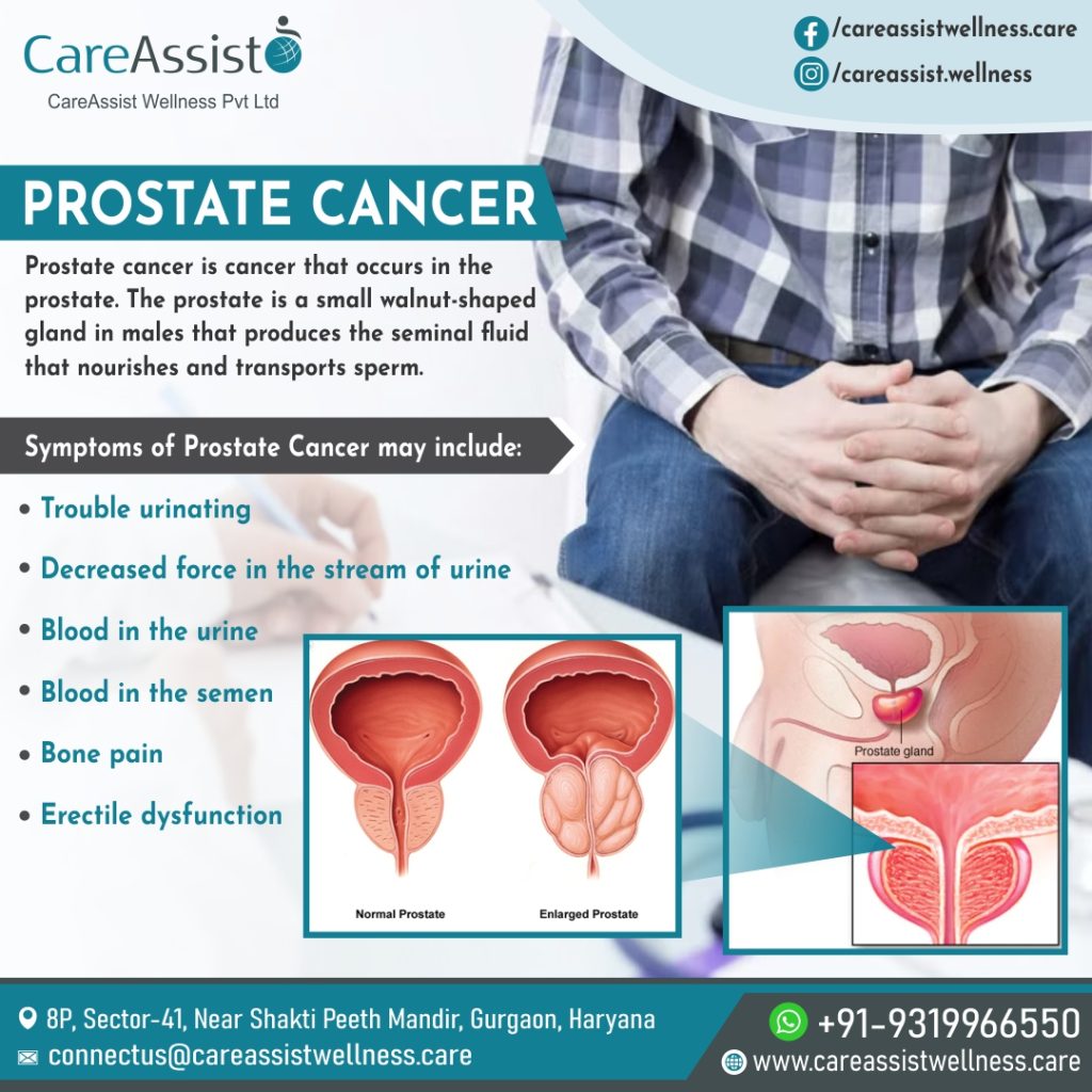 prostate cancer treatment cost in India