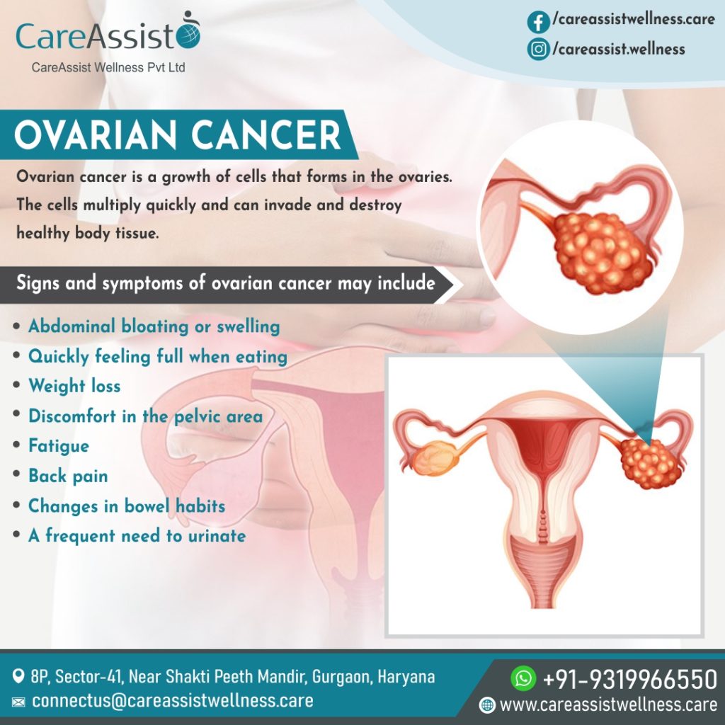 Ovarian Cancer Treatment Cost in India