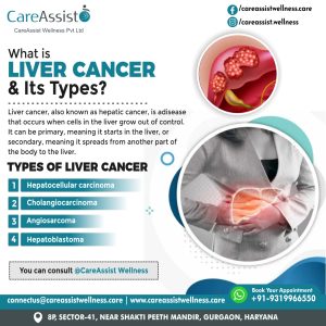 Liver Cancer Treatment